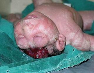 Why do we allow deformed children to be born and live ?