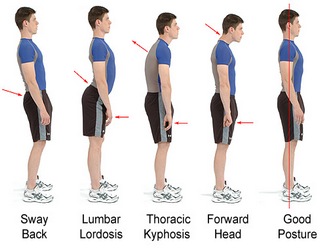 Correct your posture and you will get healthy